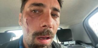 Rapper minaccia di morte Brumotti dopo l’aggressione di San Severo: allontanato dalla città