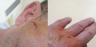 Detenuto prova a fuggire dopo udienza in Tribunale e ferisce due agenti penitenziari